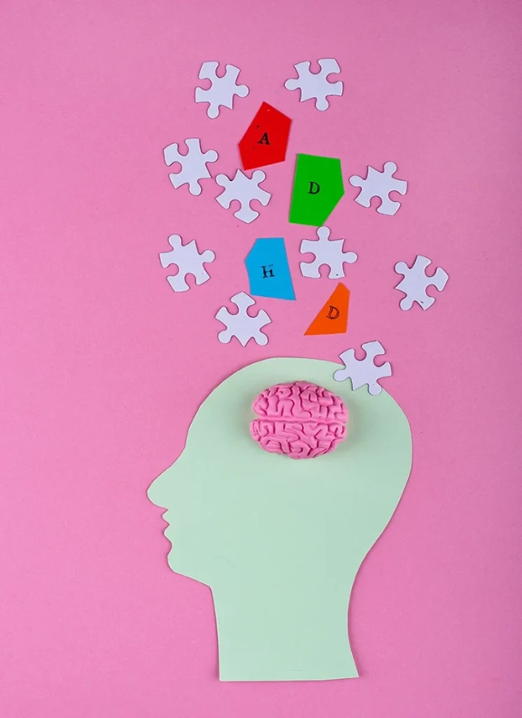 Best Brain Vitamins for Studying