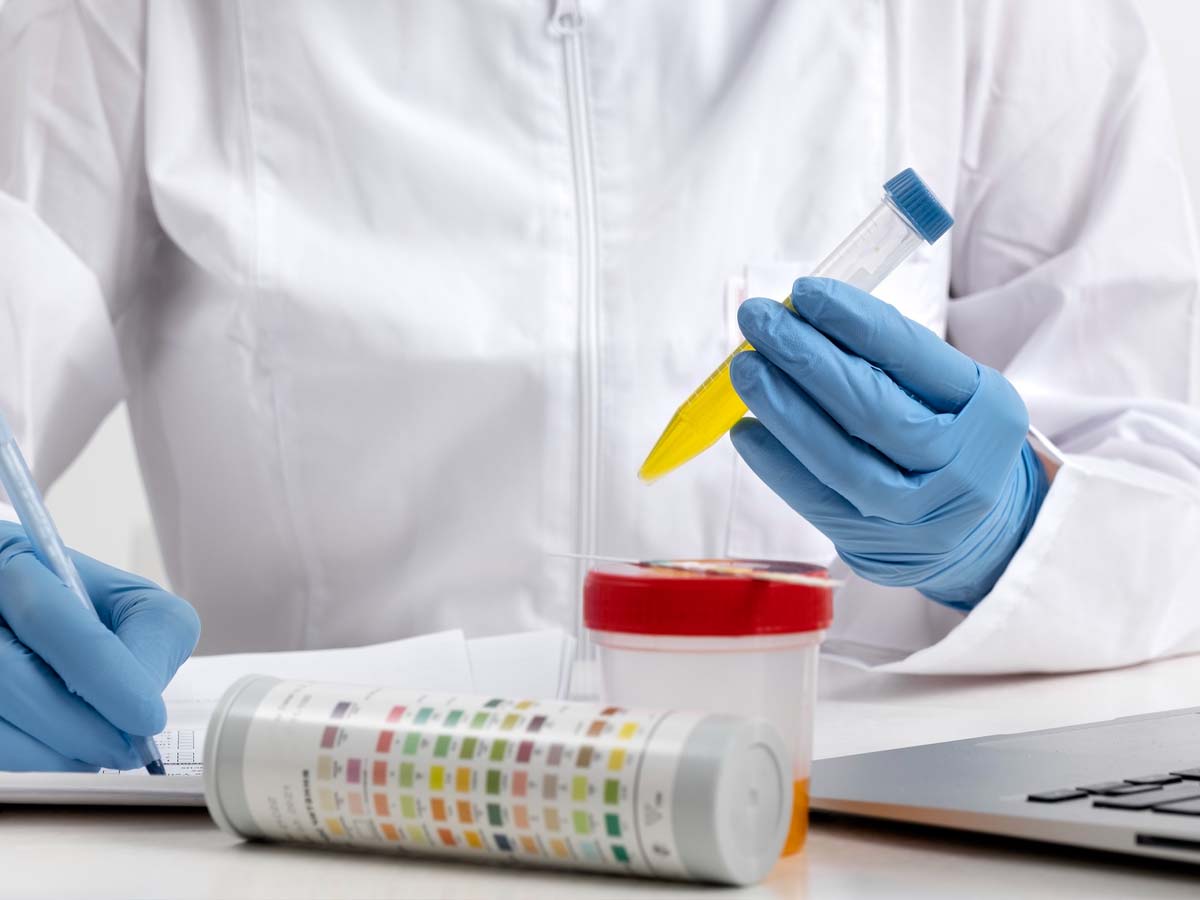 7 Reasons Why Should Athletes Be Drug-Tested