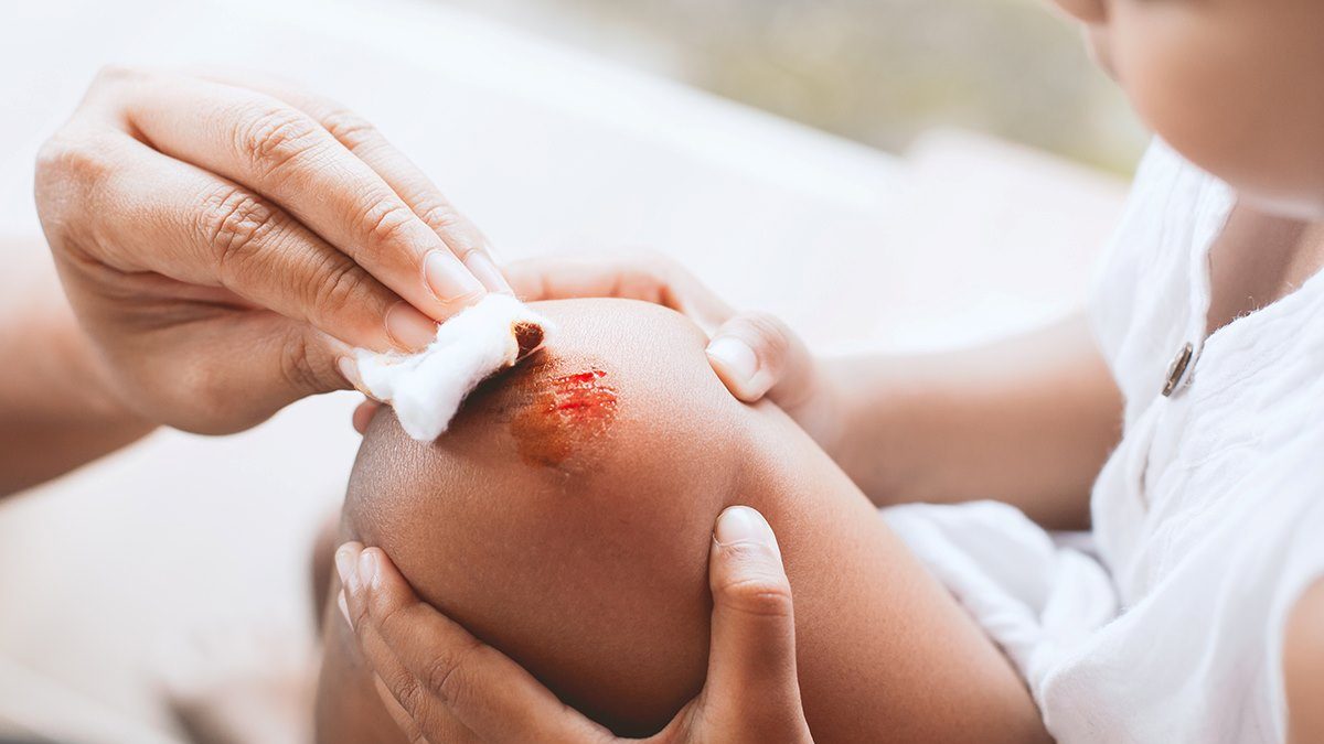 How Long Does a Wound Take to Heal?
