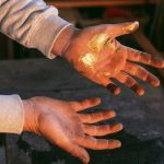 How to Accelerate Scab Healing?