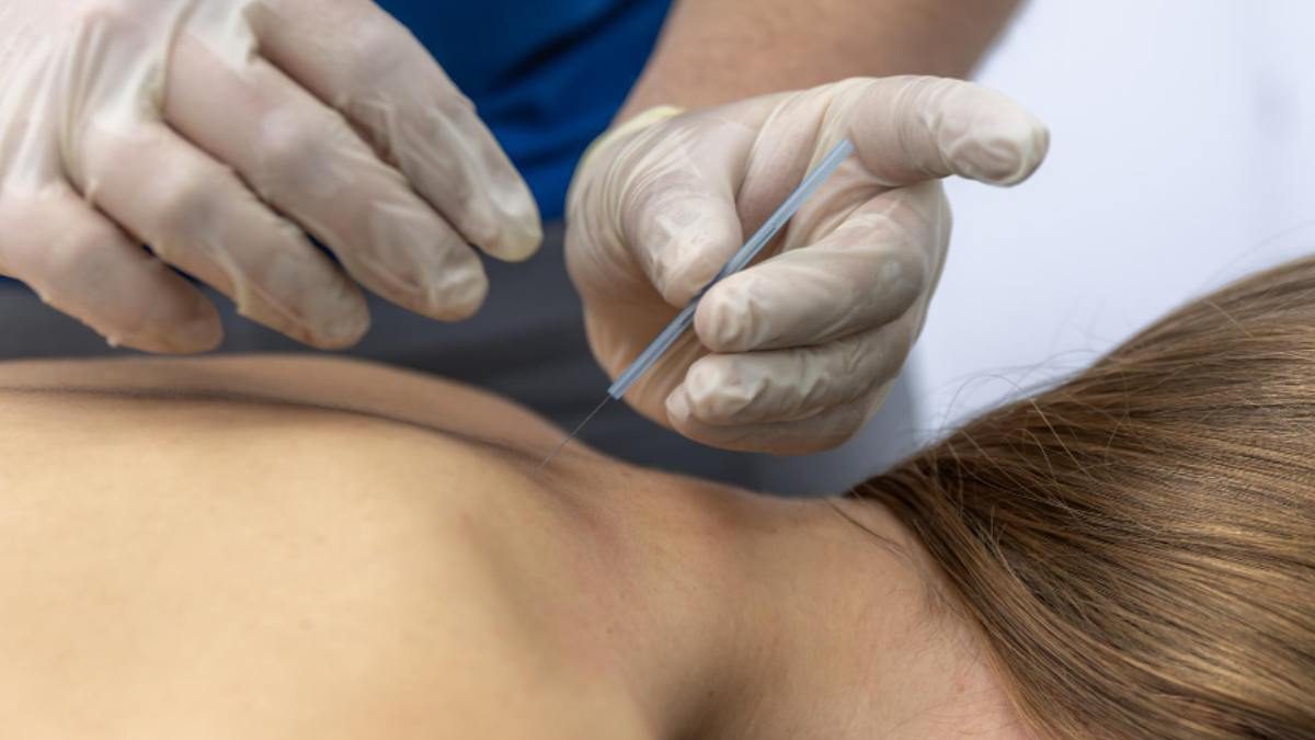Neck and Shoulder Pain in Las Vegas Is Dry Needling Right for You