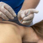 Neck and Shoulder Pain in Las Vegas Is Dry Needling Right for You