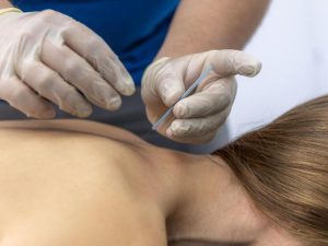 Neck and Shoulder Pain in Las Vegas Is Dry Needling Right for You