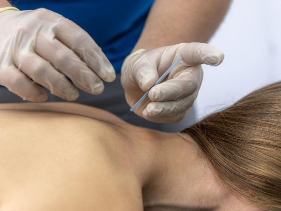 Neck and Shoulder Pain in Las Vegas Is Dry Needling Right for You